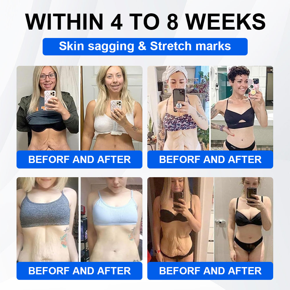 Official Store | LBMLBM® SMGT-GLP-1 Nano Microneedle Patch with Collagen & Matrixyl 3000 丨Obesity,Cardiovascular Diseas, Diabetes, Sleep Apnea, Joint Problems and More
