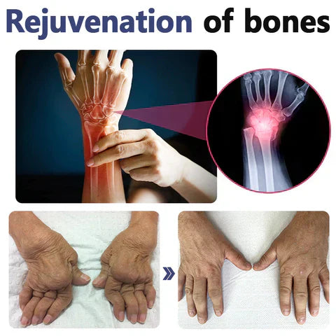 🦵(LAST DAY SALE 80% OFF)🦵Seurico™ Joint & Bone Therapy Turmeric Ginger Treatment Spray
