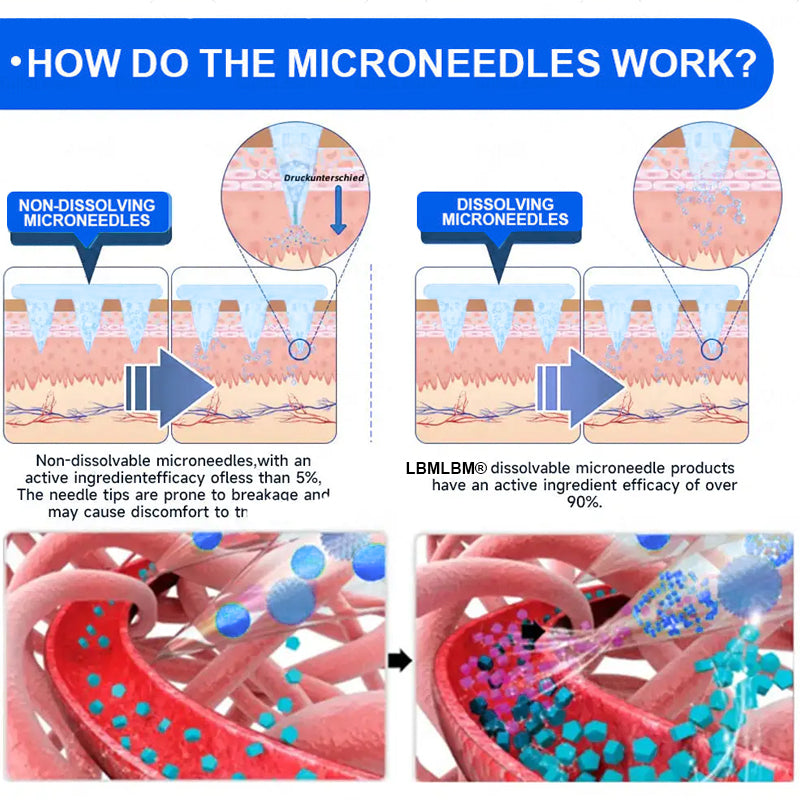 Official Store | LBMLBM® SMGT-GLP-1 Nano Microneedle Patch with Collagen & Matrixyl 3000 丨Obesity,Cardiovascular Diseas, Diabetes, Sleep Apnea, Joint Problems and More