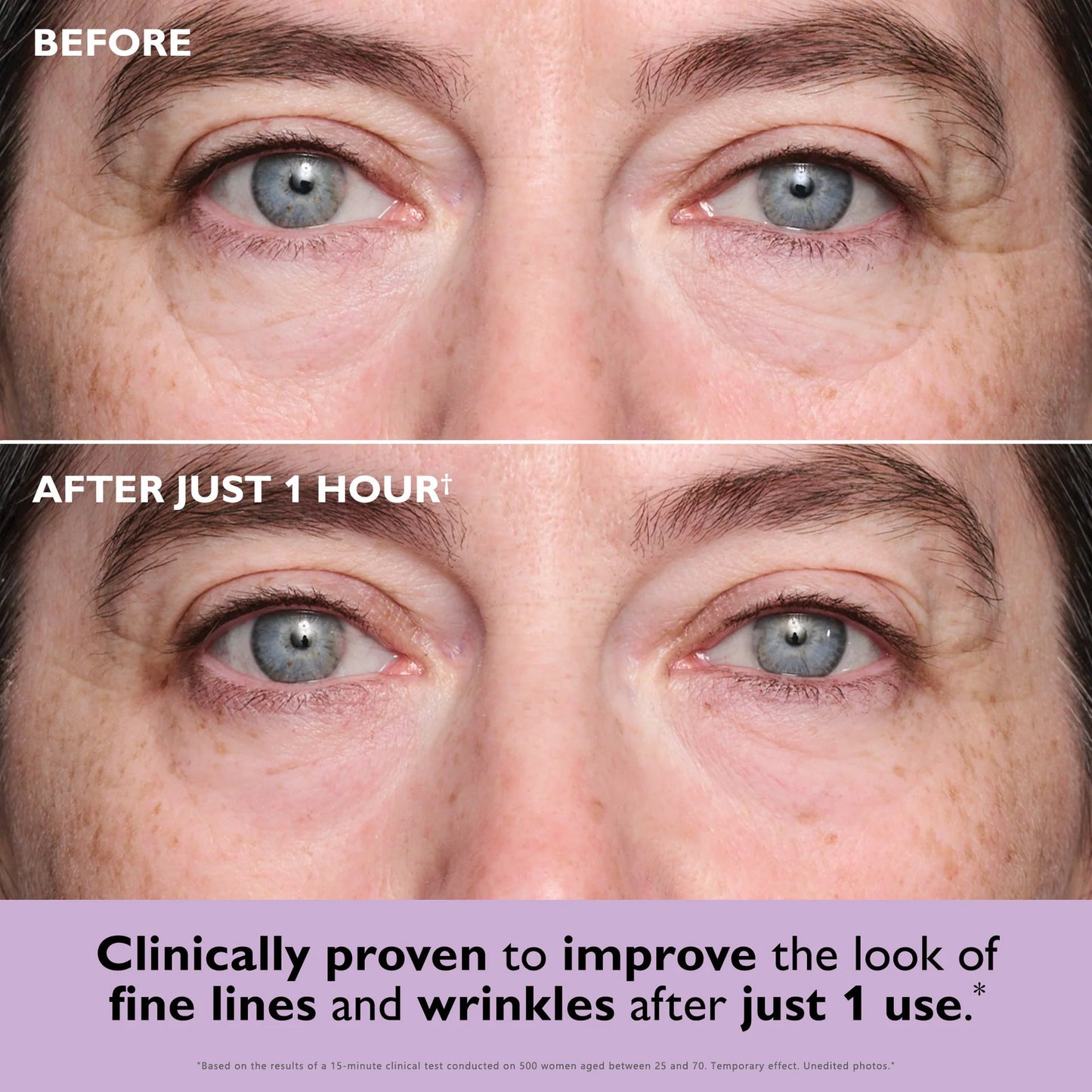🔥Limited Time Offer🔥—LBMLBM™Instant Collagen Eye Patches – Bye Puffiness & Fine Lines