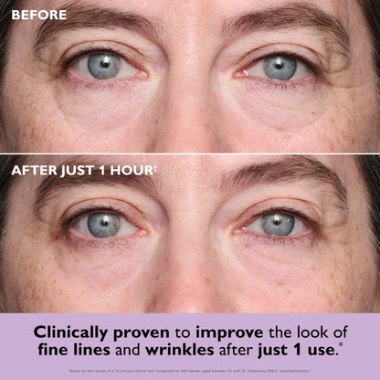 🔥Limited Time Offer🔥—LBMLBM™Instant Collagen Eye Patches – Bye Puffiness & Fine Lines