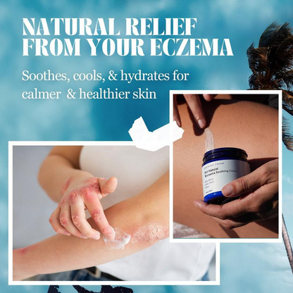 All Natural Eczema Soothing Cream