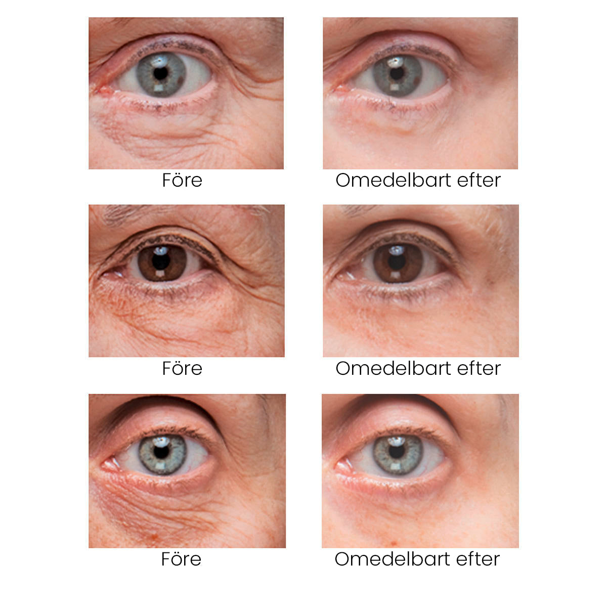 Instant Firm Eye Tightening Cream- Eliminates eye bags & wrinkles 👁✨