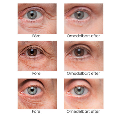 Instant Firm Eye Tightening Cream- Eliminates eye bags & wrinkles 👁✨