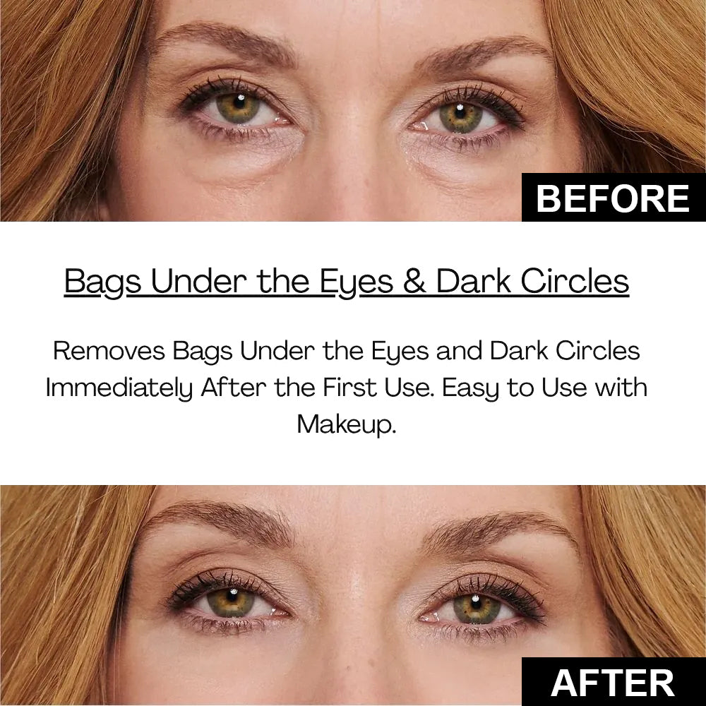 Instant Firm Eye Tightening Cream- Eliminates eye bags & wrinkles 👁✨