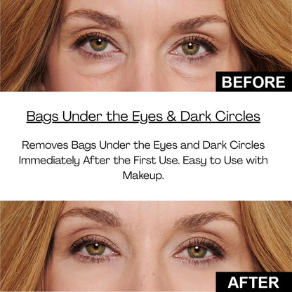 Instant Firm Eye Tightening Cream- Eliminates eye bags & wrinkles 👁✨