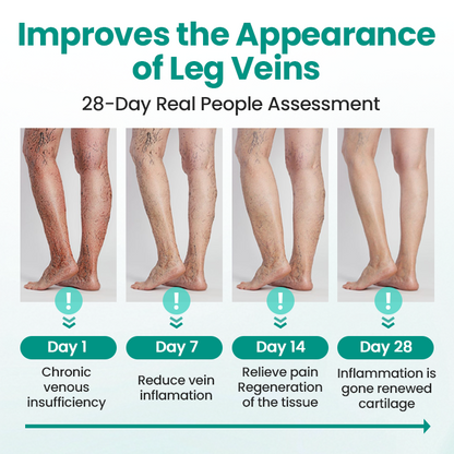 LBMLBM® LegRenew Varicose Veins Patch – The Ultimate Solution for Smooth, Healthy Legs and Varicose Vein Relief!