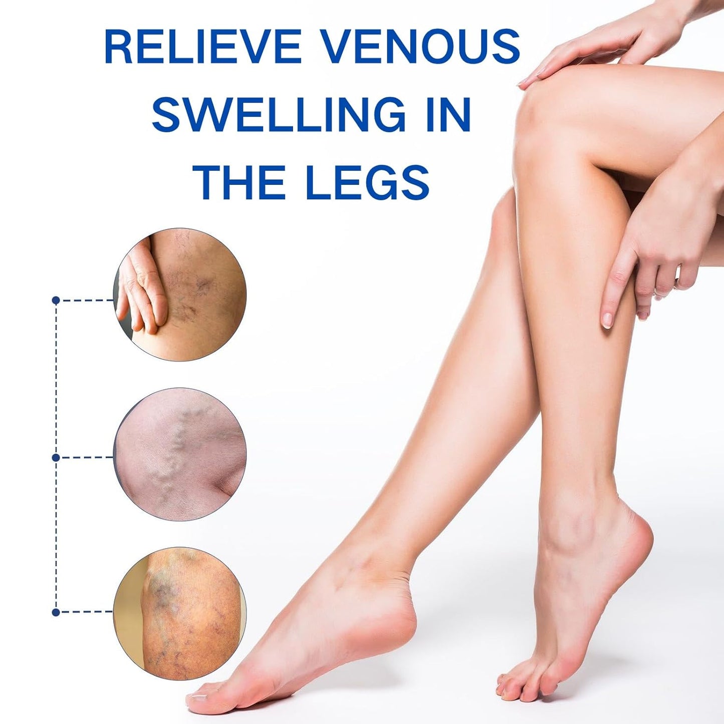 🔥NOW 50%OFF🔥-Veinhealing Varicose Veins Treatment Spray