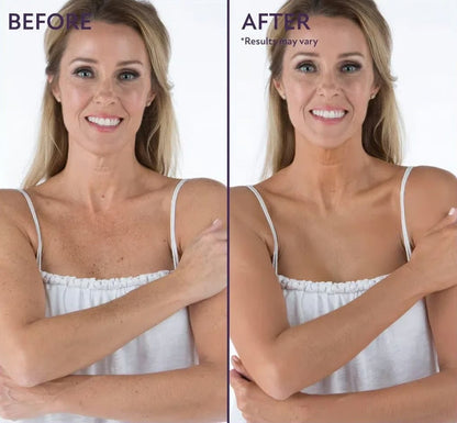 🔥Final 3 Hours: 70% OFF-3-in-1 Concealer: (Hydrates, Covers, and Color-Corrects) – 12H Waterproof & Smudge-Proof🎁