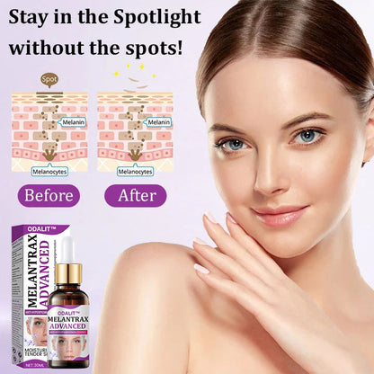 ✨ Advanced Anti-Hyperpigmentation Essence – Fade Dark Spots, Even Skin Tone & Boost Radiance in Just 2 Weeks! 🌟