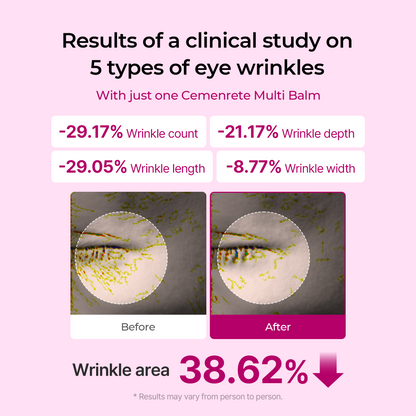 🏆Limited Time Offer🏆 — Calcium Multi-Effect Moisturizing Cream | Anti-Aging, Firming, Wrinkle Removal🔥