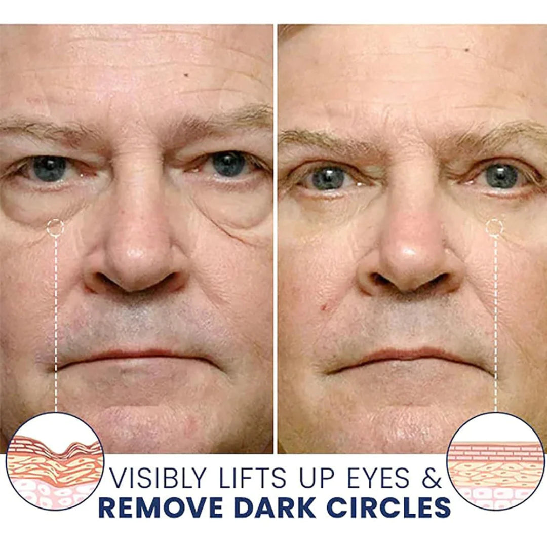 Instant Firm Eye Tightening Cream- Eliminates eye bags & wrinkles 👁✨