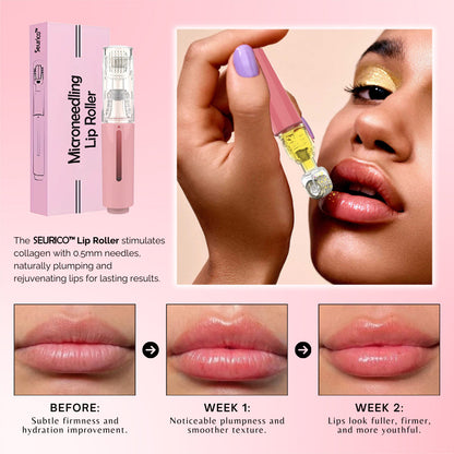 SEURICO™ MicroneedIing Lip Roller | At Home Lip Plumping Tool