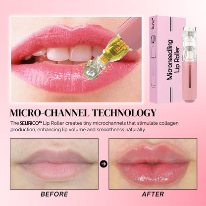 SEURICO™ MicroneedIing Lip Roller | At Home Lip Plumping Tool