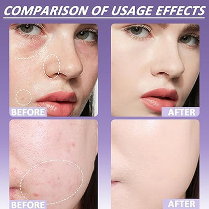 🔥Final 3 Hours: 70% OFF-3-in-1 Concealer: (Hydrates, Covers, and Color-Corrects) – 12H Waterproof & Smudge-Proof🎁